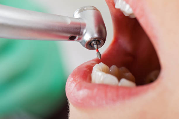 Best Emergency Dental Care for Trauma or Injury in Castle Hills, TX